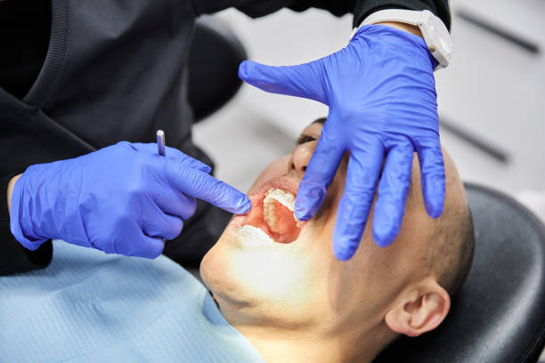 Best Root Canal Emergency Dentist  in Vail, CO